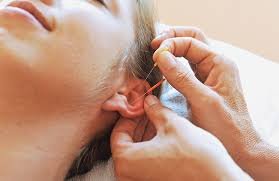 Auricular Medicine Center